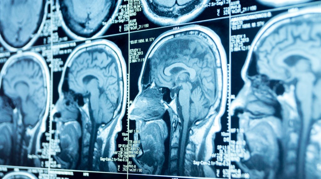 Facial trauma x-rays